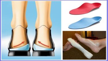 orthotic insoles manufacturers