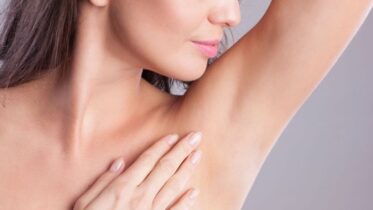 laser hair removal underarms