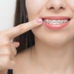 Is Orthodontic Wax Edible