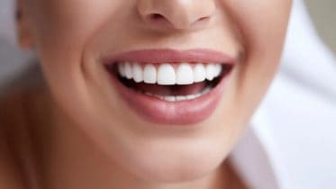 Enhance Your Smile with Porcelain Veneers