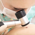 Unveiling the Importance of Mole Check Clinics Australia: Your Ultimate Mole Solution