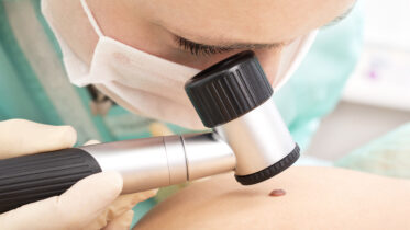 Unveiling the Importance of Mole Check Clinics Australia: Your Ultimate Mole Solution
