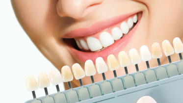 A Guide to Veneers and Cosmetic Dentistry in Sydney