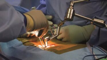 AI and the Future of Spinal Surgery